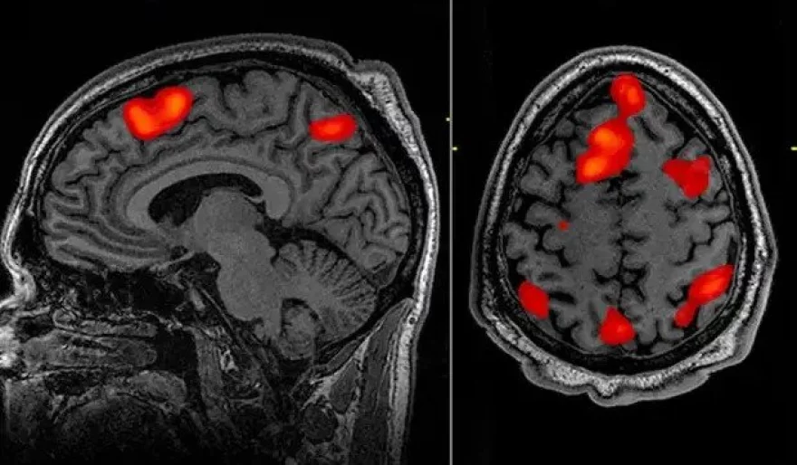 Scientists Translate Brain Activity into Text with AI Decoder