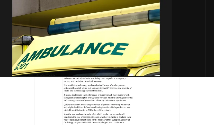 AI Tool Triples Stroke Recovery in England